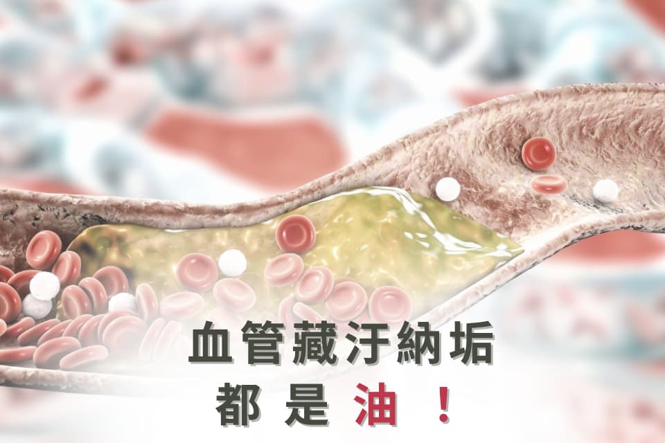 水管不通找通樂，您的血管不通怎麼辦？ - 正欣診所