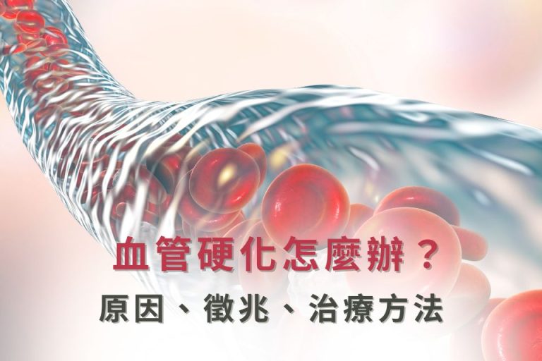 血管硬化處理，揭示原因與治療方法，強化血管健康。