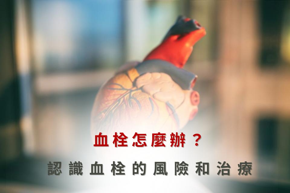 血栓怎麼辦?一篇掌握血栓風險、成因、症狀與常見治療問題 - 正欣診所