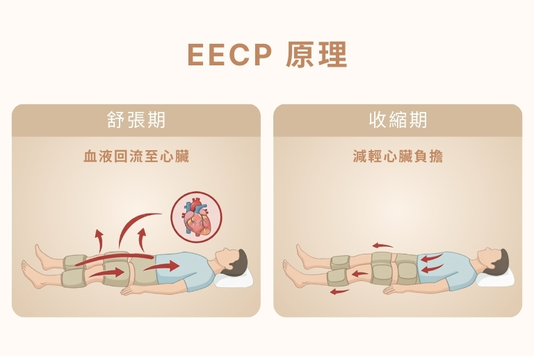 eecp
