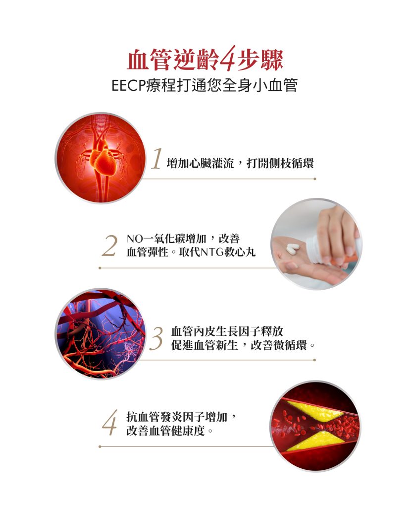 EECP療程促進血管逆齡4步驟，增加心臟灌流、提升血管彈性、刺激血管新生、改善發炎指數，有效打通全身微血管。