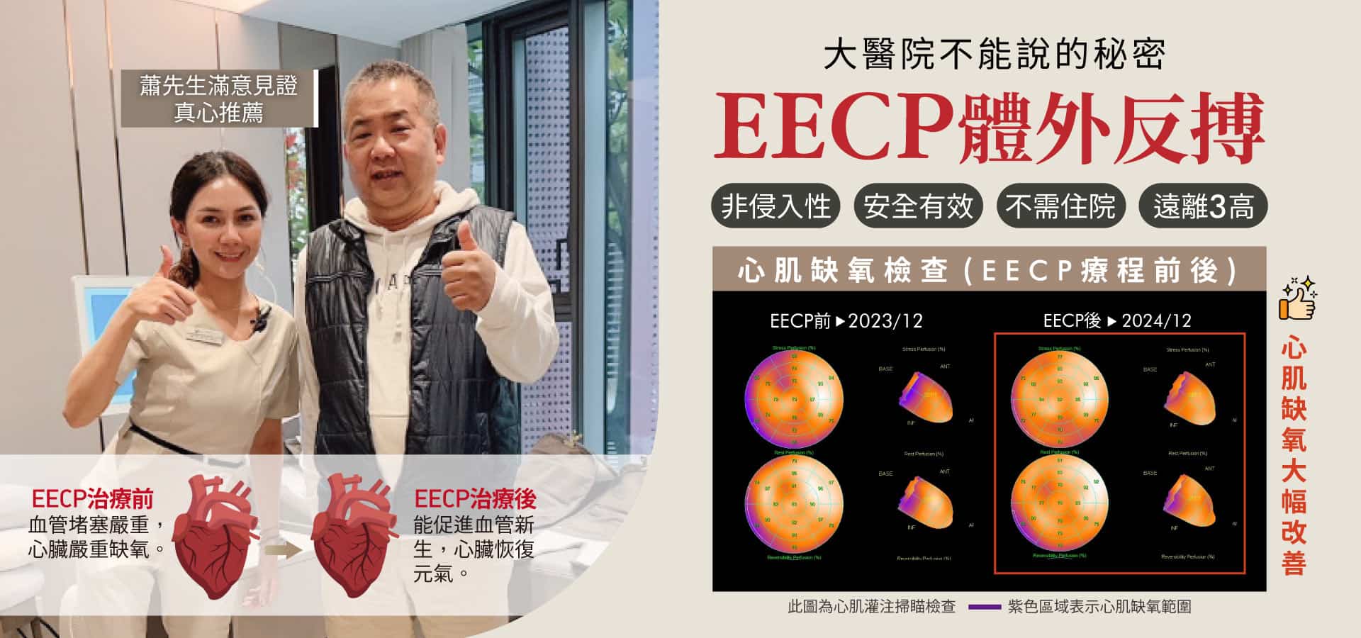 EECP體外反搏療程，經薛先生實證推薦，有效促進血管新生，改善心肌缺氧狀況，顯著提升心臟功能。